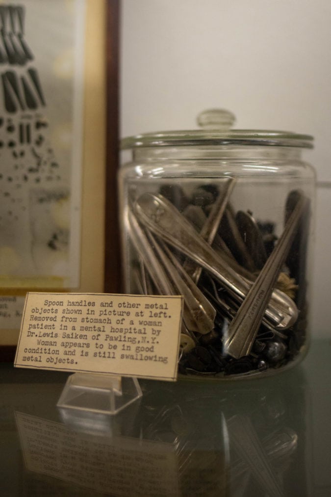 A glass jar containing metal objects, mostly spoon handles, removed from the stomach of a woman